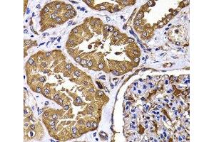 Immunohistochemistry of paraffin-embedded Human kidney using TGS1 Polyclonal Antibody at dilution of 1:100 (40x lens). (TGS1 Antikörper)