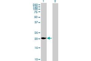 Western Blot analysis of MAGEH1 expression in transfected 293T cell line by MAGEH1 MaxPab polyclonal antibody. (MAGEH1 Antikörper  (AA 1-219))
