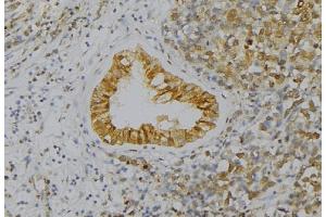 ABIN6277560 at 1/100 staining Human uterus tissue by IHC-P.