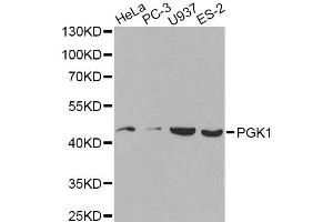 Western blot analysis of extracts of various cell lines, using PGK1 antibody (ABIN6290734) at 1:1000 dilution. (PGK1 Antikörper)