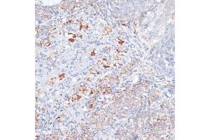 Immunohistochemistry of paraffin-embedded rat ovary using SMPD1 antibody. (SMPD1 Antikörper  (AA 70-340))