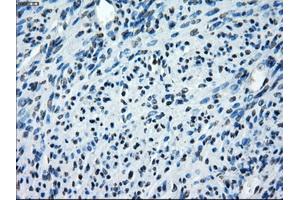 Immunohistochemical staining of paraffin-embedded endometrium tissue using anti-SATB1mouse monoclonal antibody. (SATB1 Antikörper)