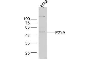 Human k562 lysates probed with Rabbit Anti-P2Y9 Polyclonal Antibody, Unconjugated  at 1:300 overnight at 4˚C. (LPAR4 Antikörper  (AA 175-270))