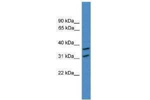 WB Suggested Anti-OTUD6A Antibody Titration: 0.
