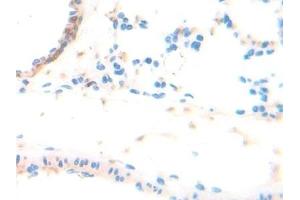 Detection of ADPN in Rat Lung Tissue using Polyclonal Antibody to Adiponectin (ADPN) (ADIPOQ Antikörper  (AA 111-244))