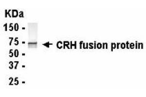 Western Blotting (WB) image for anti-Corticotropin Releasing Hormone (CRH) (AA 27-196) antibody (ABIN2467797) (CRH Antikörper  (AA 27-196))