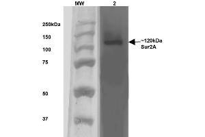 Western Blotting (WB) image for anti-ATP-Binding Cassette, Sub-Family C (CFTR/MRP), Member 9 (ABCC9) (AA 1505-1546) antibody (PE) (ABIN2482983)