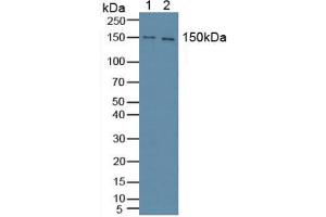 Figure. (Phospholipase C gamma 1 Antikörper  (AA 1091-1290))