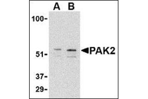 Western blot analysis of PAK2 in Jurkat lysate with this product at (A) 0. (PAK2 Antikörper  (C-Term))