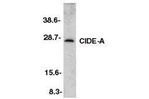 Western blot analysis of CIDE-A in murine heart tissue lysate with CIDE-A antibody at 2ug/ml. (CIDEA Antikörper  (AA 200-214))