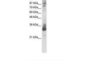 Image no. 1 for anti-RNA (Guanine-9-) Methyltransferase Domain Containing 2 (RG9MTD2) (AA 181-230) antibody (ABIN202281) (RG9MTD2 Antikörper  (AA 181-230))
