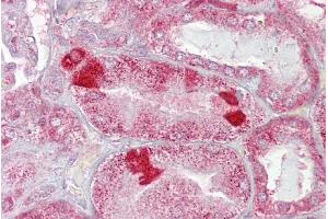 Immunohistochemistry with Kidney tissue at an antibody concentration of 5µg/ml using anti-AMACR antibody (ARP60806_P050)