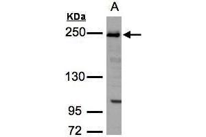 WB Image Sample(30 ug whole cell lysate) A:H1299 5% SDS PAGE antibody diluted at 1:3000 (TJP1 Antikörper  (N-Term))