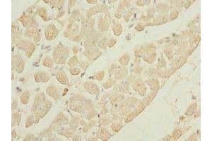 Immunohistochemistry of paraffin-embedded human heart tissue using ABIN7163881 at dilution of 1:100
