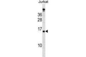 Western blot analysis in Jurkat cell line lysates (35ug/lane) using PLAC4  Antibody . (PLAC4 Antikörper  (N-Term))