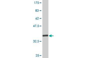 Western Blot detection against Immunogen (35. (CDK4 Antikörper  (AA 211-303))