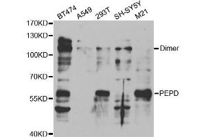 Western blot analysis of extracts of various cell lines, using PEPD antibody (ABIN5973143) at 1/1000 dilution. (PEPD Antikörper)