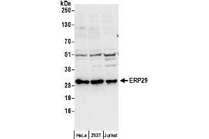 Western Blotting (WB) image for anti-Endoplasmic Reticulum Protein 29 (ERP29) (AA 75-125) antibody (ABIN7453081)