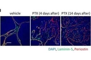 Immunofluorescence (Paraffin-embedded Sections) (IF (p)) image for anti-Periostin (POSTN) (C-Term) antibody (ABIN2854805)