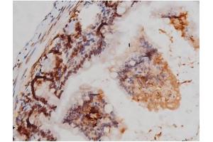 ABIN6267362 at 1/200 staining Mouse intestinal tissue sections by IHC-P. (MAPT Antikörper  (pThr205))