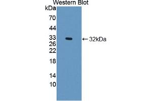 Western blot analysis of the recombinant protein. (DOCK2 Antikörper  (AA 390-635))