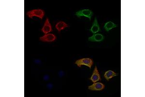 ABIN6257652 and ABIN6275247 staining Hela cells by IF/ICC.