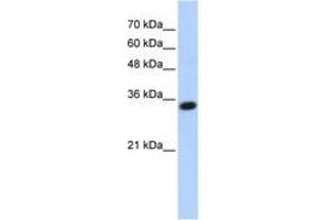 Image no. 1 for anti-Complement C1q Tumor Necrosis Factor-Related Protein 4 (C1QTNF4) (AA 107-156) antibody (ABIN6743640) (C1QTNF4 Antikörper  (AA 107-156))