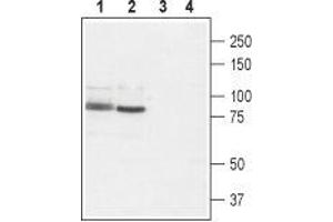 Western blot analysis of rat brain (lanes 1 and 3) and rat RBL basophilic leukemia cell lysate (lanes 2 and 4): - 1,2. (TRPV2 Antikörper  (1st Extracellular Loop))