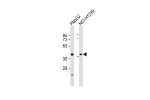 All lanes : Anti-CREB3 Antibody (C-term) at 1:8000 dilution Lane 1: HepG2 whole cell lysates Lane 2: NCI- whole cell lysates Lysates/proteins at 20 μg per lane. (CREB3 Antikörper  (C-Term))