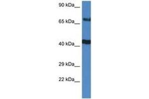 Image no. 1 for anti-TNFAIP3 Interacting Protein 1 (TNIP1) (C-Term) antibody (ABIN6747407) (TNIP1 Antikörper  (C-Term))
