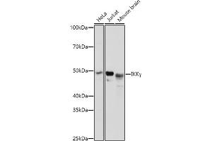 Western blot analysis of extracts of various cell lines, using IKKγ antibody (ABIN3021150, ABIN3021151, ABIN3021152 and ABIN6214025) at 1:3000 dilution.