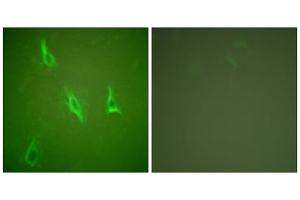 Immunofluorescence analysis of HeLa cells, using Caspase 10 antibody.