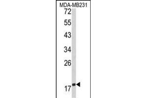 Western blot analysis of CD28 Antibody (C-term) (ABIN390970 and ABIN2841150) in MDA-M cell line lysates (35 μg/lane). (CD28 Antikörper  (C-Term))