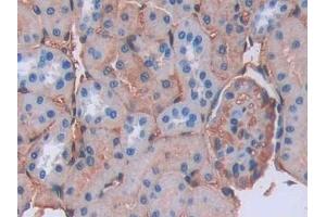 Detection of LCNL1 in Rat Kidney Tissue using Polyclonal Antibody to Lipocalin Like Protein 1 (LCNL1) (LCNL1 Antikörper)