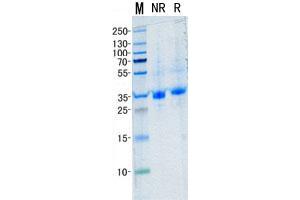 Western Blotting (WB) image for TIMP Metallopeptidase Inhibitor 1 (TIMP1) (Transcript Variant 2) (Active) protein (His tag) (ABIN2733748)