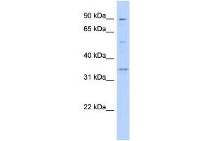 Western Blotting (WB) image for anti-Wingless-Type MMTV Integration Site Family, Member 9B (WNT9B) (Middle Region) antibody (ABIN2776703)