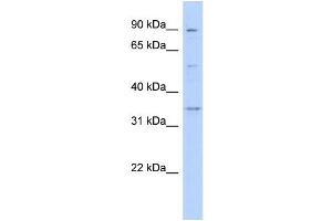 WB Suggested Anti-WNT9B Antibody Titration:  0. (WNT9B Antikörper  (Middle Region))