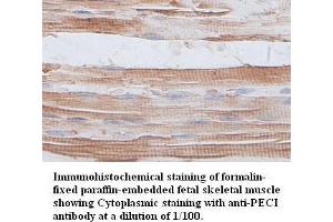 Image no. 1 for anti-Enoyl-CoA Delta Isomerase 2 (PECI) antibody (ABIN791176) (PECI/ECI2 Antikörper)