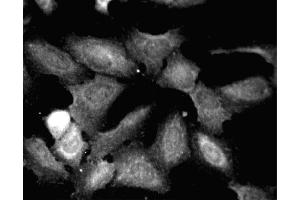 Immunofluorescent staining of HeLa (ATCC CCL-2) cells. (Paxillin Antikörper  (AA 1-557))