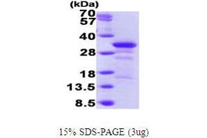 SDS-PAGE (SDS) image for Partner of Y14 and mago (WIBG) (AA 1-204) protein (His tag) (ABIN7529154) (PYM Protein (AA 1-204) (His tag))