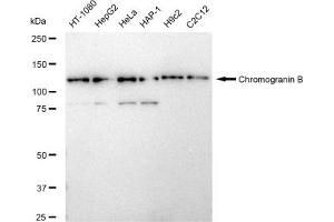 Western blotting analysis using Chromogranin B antibody (ABIN7798073).