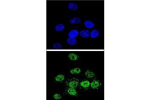 Confocal immunofluorescent analysis of MEF2A Antibody (Center) (ABIN653206 and ABIN2842748) with Hela cell followed by Alexa Fluor® 488-conjugated goat anti-rabbit lgG (green). (MEF2A Antikörper  (AA 453-479))