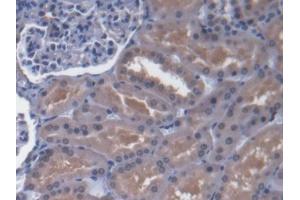 Immunohistochemistry (IHC) image for anti-ATP-Binding Cassette, Sub-Family D (Ald), Member 4 (ABCD4) (AA 356-606) antibody (ABIN5013197)