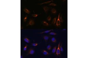 Immunofluorescence analysis of U-2 OS cells using VMP1 Polyclonal Antibody (ABIN7271283) at dilution of 1:100 (40x lens). (VMP1 Antikörper  (C-Term))