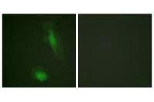 Immunofluorescence analysis of HeLa cells, using Akt (Ab-129) antibody. (AKT1 Antikörper  (Ser129))