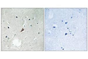 Immunohistochemistry analysis of paraffin-embedded human brain tissue using PYK2 (Phospho-Tyr579) antibody. (PTK2B Antikörper  (pTyr579))