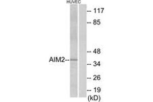 Western blot analysis of extracts from HuvEc cells, using AIM2 Antibody. (AIM2 Antikörper  (AA 51-100))