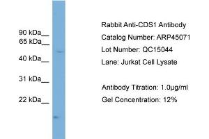 WB Suggested Anti-CDS1  Antibody Titration: 0. (CDS1 Antikörper  (N-Term))