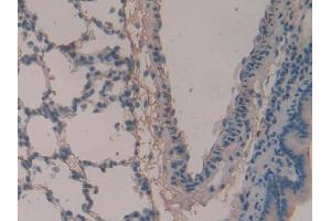 DAB staining on IHC-P; Samples: Rat Lung Tissue (Periostin Antikörper  (AA 659-810))