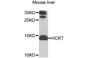 Western blot analysis of extracts of mouse liver, using HCRT antibody (ABIN6003553) at 1/1000 dilution.